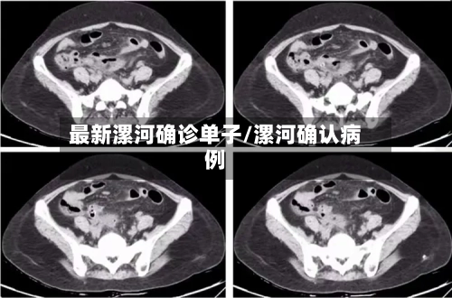 最新漯河确诊单子/漯河确认病例