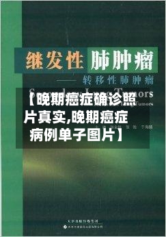 【晚期癌症确诊照片真实,晚期癌症病例单子图片】