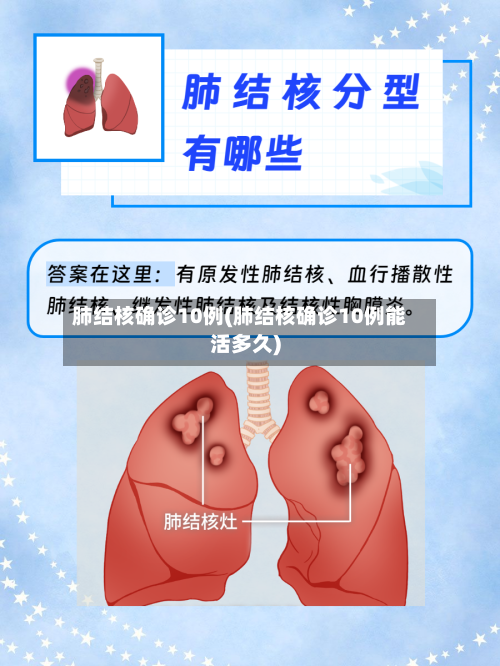 肺结核确诊10例(肺结核确诊10例能活多久)