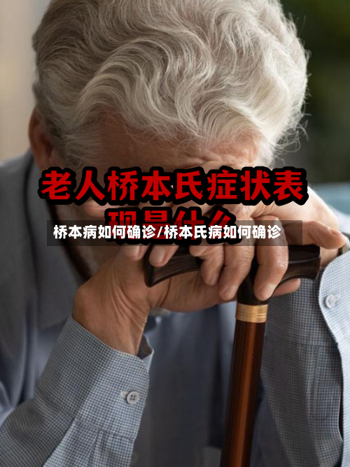 桥本病如何确诊/桥本氏病如何确诊