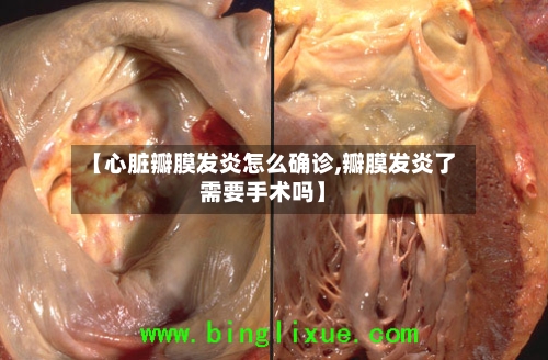 【心脏瓣膜发炎怎么确诊,瓣膜发炎了需要手术吗】