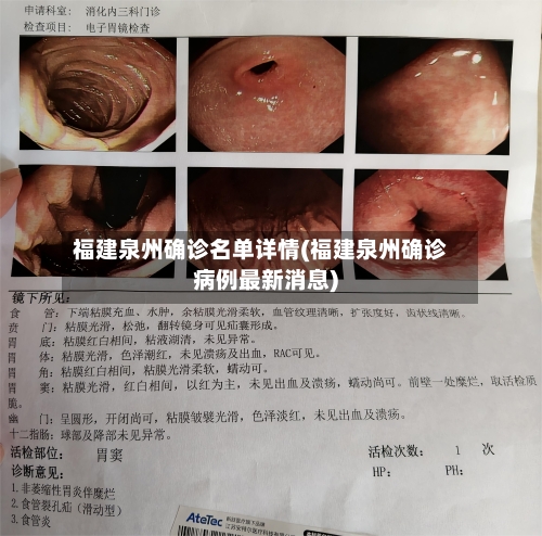 福建泉州确诊名单详情(福建泉州确诊病例最新消息)