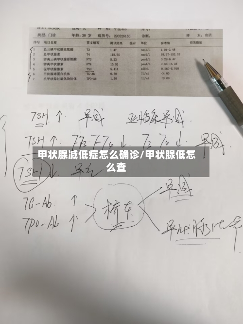 甲状腺减低症怎么确诊/甲状腺低怎么查