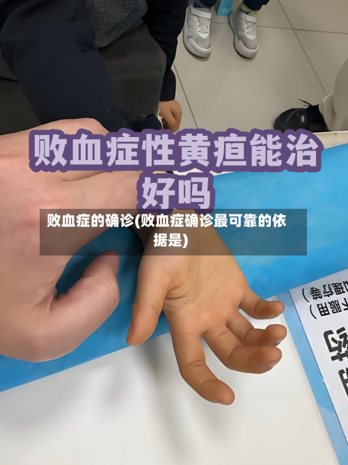 败血症的确诊(败血症确诊最可靠的依据是)