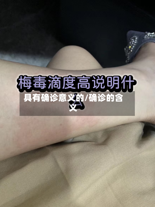 具有确诊意义的/确诊的含义