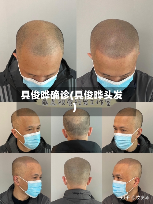 具俊晔确诊(具俊晔头发)
