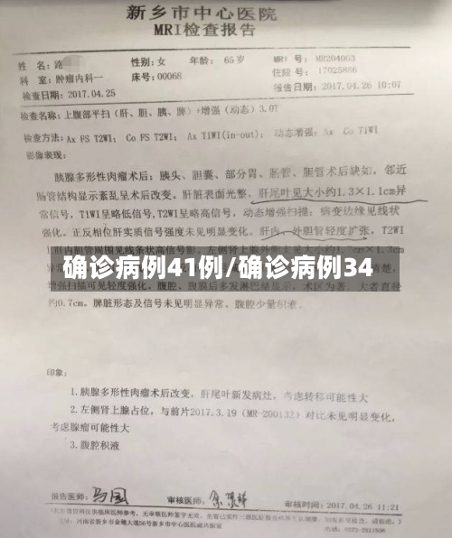 确诊病例41例/确诊病例34