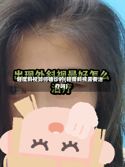 轻度斜视如何确诊的(轻度斜视需要治疗吗)
