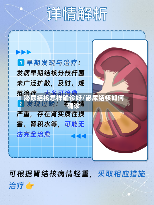 泌尿结核怎样确诊好/泌尿结核如何确诊