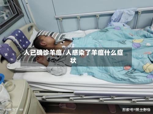 人已确诊羊瘟/人感染了羊瘟什么症状