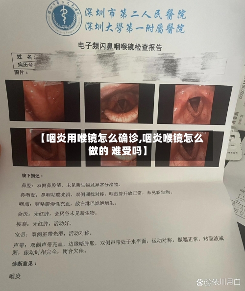 【咽炎用喉镜怎么确诊,咽炎喉镜怎么做的 难受吗】