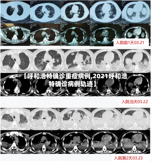 【呼和浩特确诊重症病例,2021呼和浩特确诊病例轨迹】
