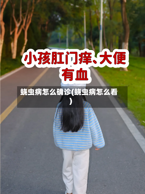 蛲虫病怎么确诊(蛲虫病怎么看)