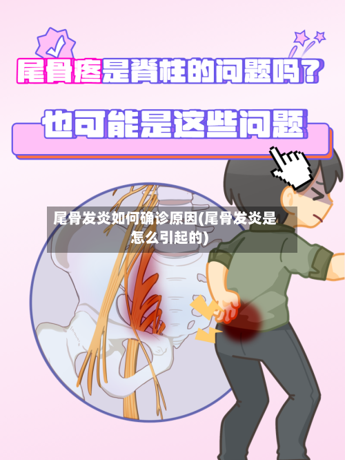 尾骨发炎如何确诊原因(尾骨发炎是怎么引起的)