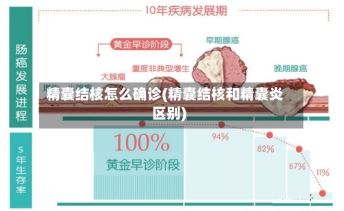 精囊结核怎么确诊(精囊结核和精囊炎区别)