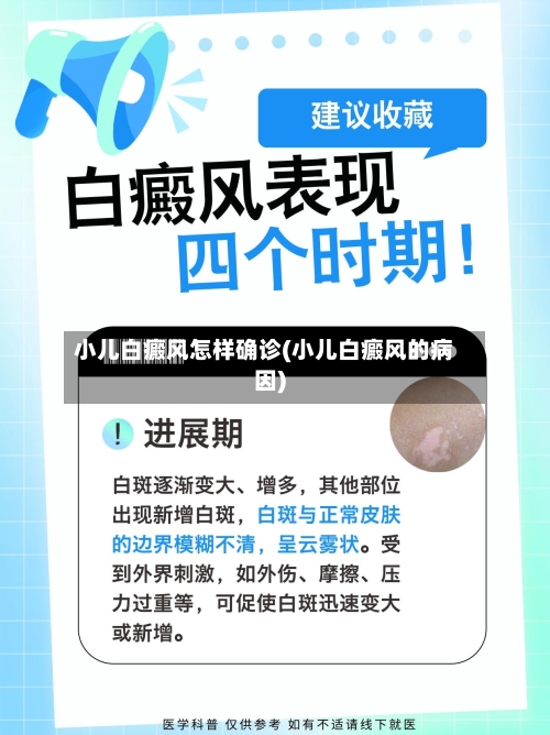 小儿白癜风怎样确诊(小儿白癜风的病因)