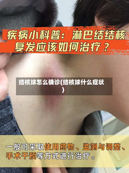 结核球怎么确诊(结核球什么症状)