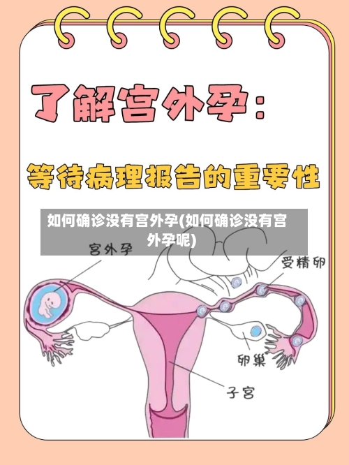 如何确诊没有宫外孕(如何确诊没有宫外孕呢)