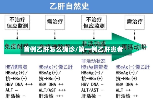 首例乙肝怎么确诊/第一例乙肝患者