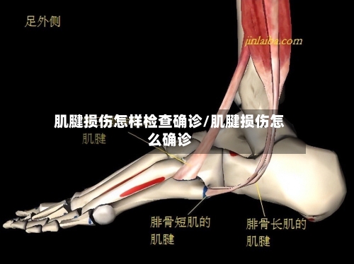 肌腱损伤怎样检查确诊/肌腱损伤怎么确诊
