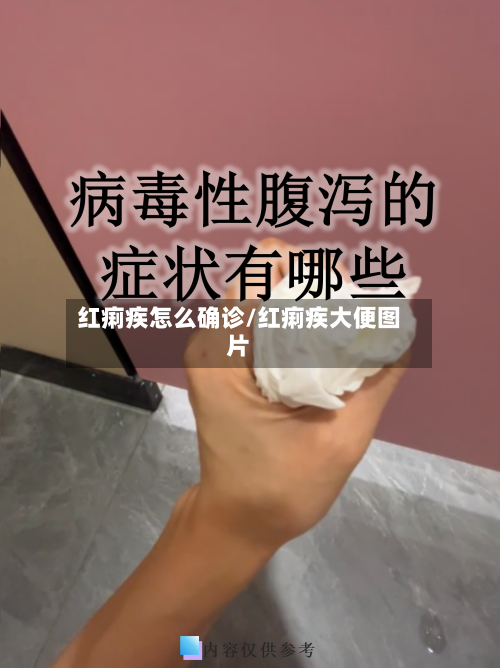 红痢疾怎么确诊/红痢疾大便图片