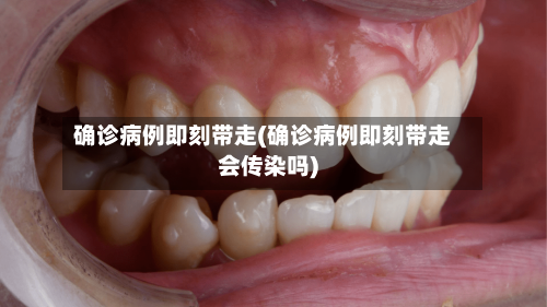 确诊病例即刻带走(确诊病例即刻带走会传染吗)