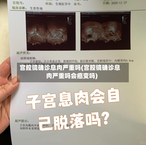 宫腔镜确诊息肉严重吗(宫腔镜确诊息肉严重吗会癌变吗)