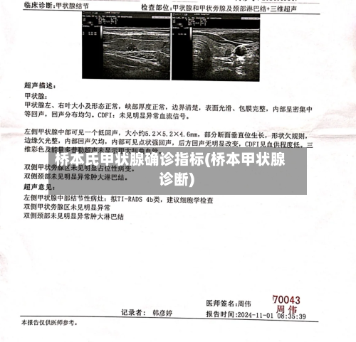桥本氏甲状腺确诊指标(桥本甲状腺 诊断)