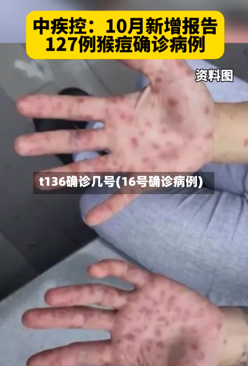 t136确诊几号(16号确诊病例)